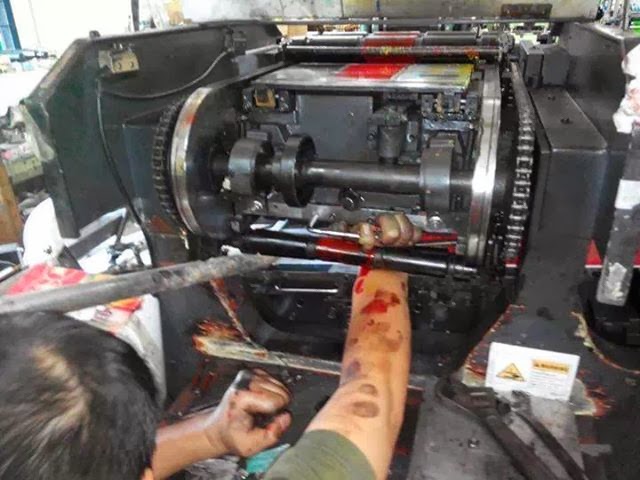 Apakah Itu ESC dan Bagaimana Ia Elakkan Kemalangan?